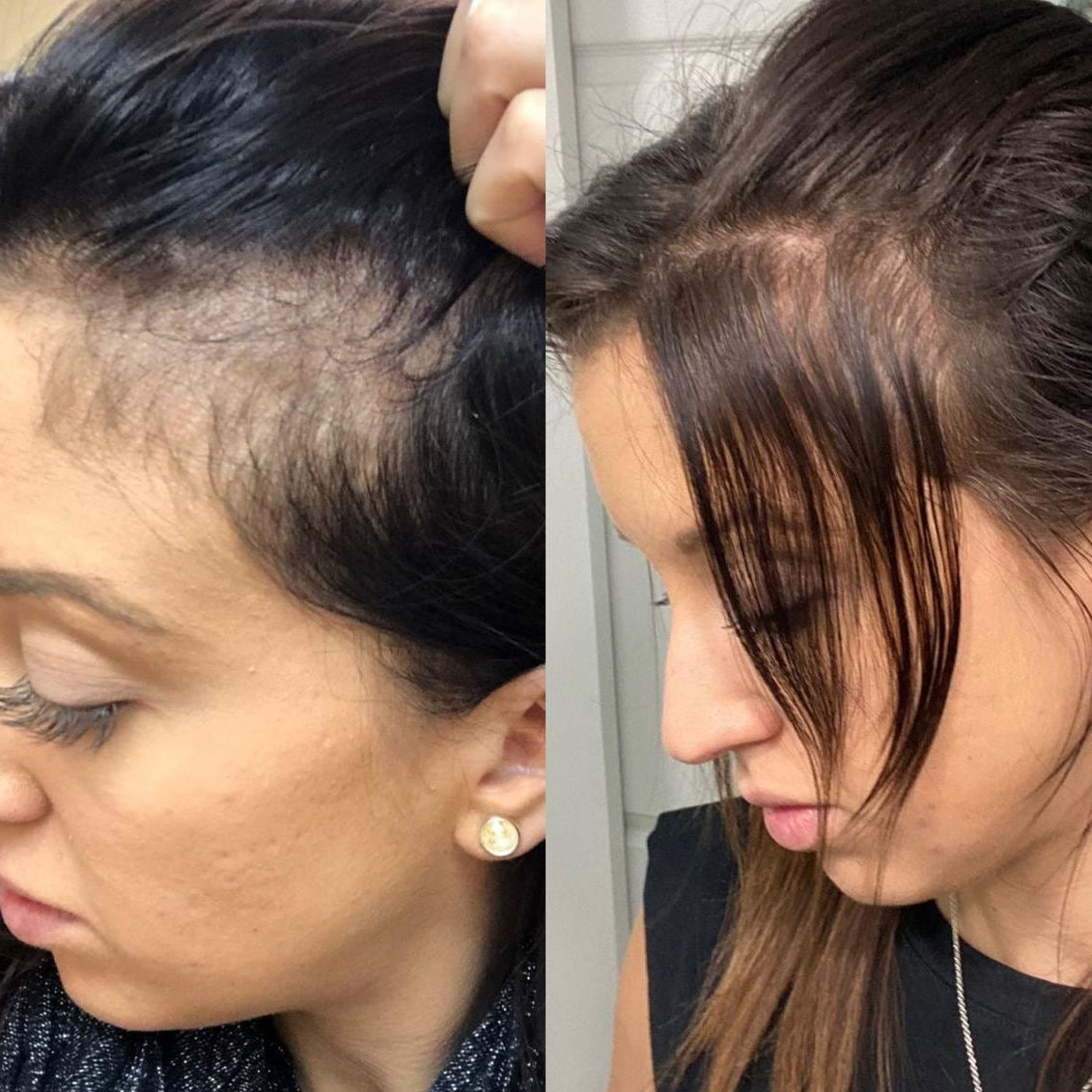 Maschera naturale per la crescita dei capelli (Olio 100% di Batana)