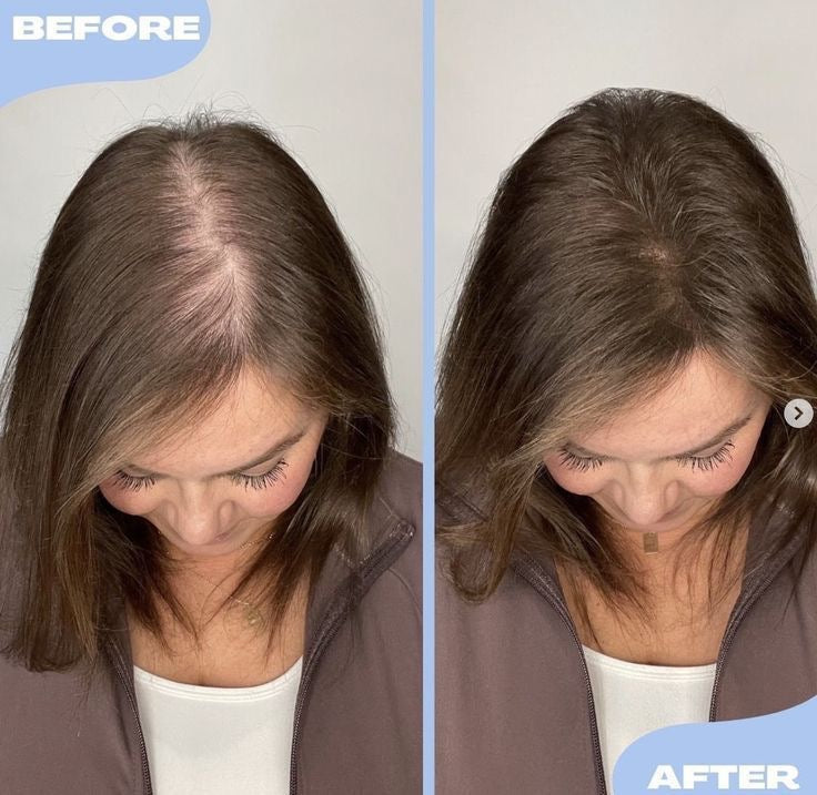 Maschera naturale per la crescita dei capelli (Olio 100% di Batana)