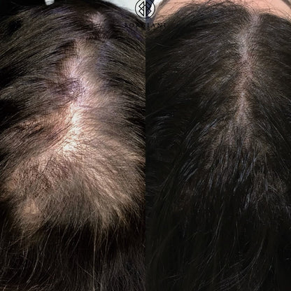 Maschera naturale per la crescita dei capelli (Olio 100% di Batana)